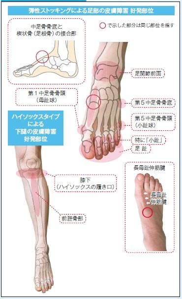 セール＆特集＞ 絶妙なデザイン足首の長さの圧縮ストッキング静脈瘤のための弾力性のある軽い圧力のストッキング S gts.com.pe